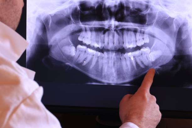 Best Same-Day Emergency Dentist in Mason City, IA